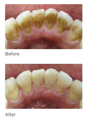 Before and after Cleaning